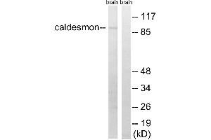 Western blot analysis of extracts from mouse brain cells, using Caldesmon (Ab-759) antibody. (Caldesmon antibody  (Ser759))