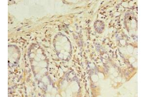 Immunohistochemistry of paraffin-embedded human small intestine tissue using ABIN7167776 at dilution of 1:100 (PDE6D antibody  (AA 1-150))