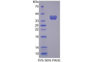 Image no. 1 for Protocadherin beta 16 (PCDHB16) (AA 35-347) protein (His tag) (ABIN6237023) (PCDHB16 Protein (AA 35-347) (His tag))