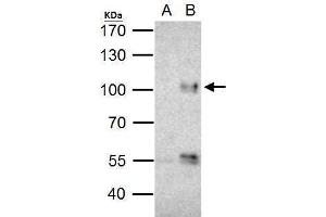 IP Image FOXO3A antibody immunoprecipitates FOXO3A protein in IP experiments. (FOXO3 antibody  (C-Term))