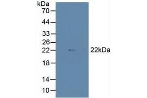 Detection of MAX in Porcine Heart Tissue using Polyclonal Antibody to MYC Associated Factor X (MAX) (MAX antibody  (AA 2-160))