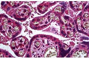 Human Placenta, Trophoblast: Formalin-Fixed, Paraffin-Embedded (FFPE) (ERBB3 antibody  (AA 1-131))