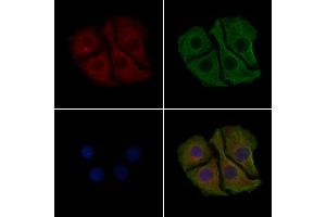 ABIN6261244 and ABIN6279380 staining Hela cells by IF/ICC.