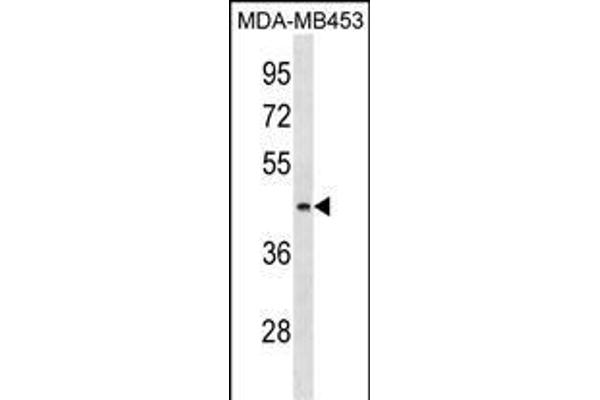 ALG8 Antikörper  (N-Term)