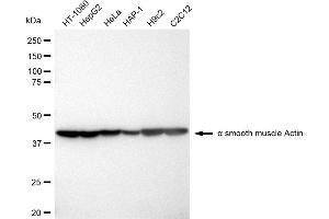 Western blotting analysis using alpha smooth muscle Actin antibody (ABIN7797464). (Recombinant Smooth Muscle Actin antibody)