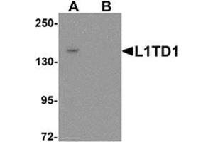 Western blot analysis of L1TD1 in Jurkat cell lysate with L1TD1 antibody at 1 ug/mL in (A) the absence and (B) the presence of blocking peptide. (L1TD1 antibody  (C-Term))