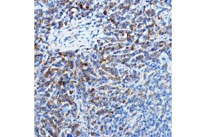 Immunohistochemistry of paraffin-embedded mouse spleen using Bax Rabbit mAb  at dilution of 1:25,1:50 (40x lens).