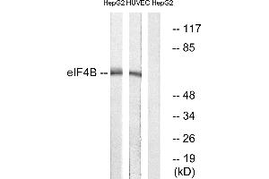 Immunohistochemistry analysis of paraffin-embedded human colon carcinoma tissue using eIF4B (Ab-422) antibody.