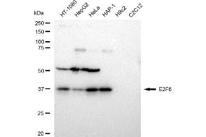 Western blotting analysis using E2F6 antibody (ABIN7798416).