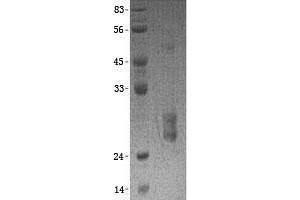 Validation with Western Blot (PPCDC Protein (His tag))