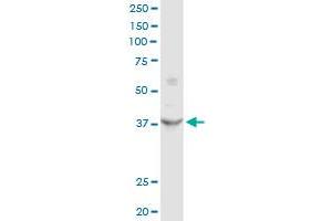 FRZB MaxPab rabbit polyclonal antibody. (FRZB antibody  (AA 1-325))