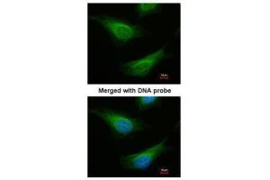 ICC/IF Image Immunofluorescence analysis of paraformaldehyde-fixed HeLa, using FANCC, antibody at 1:200 dilution. (FANCC antibody  (Center))