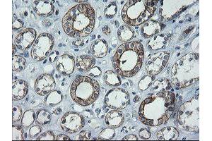 Image no. 4 for anti-Chromosome 2 Open Reading Frame 62 (C2orf62) antibody (ABIN1497054) (C2orf62 antibody)