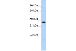 WB Suggested Anti-MNX1 Antibody Titration:  0. (MNX1 antibody  (N-Term))