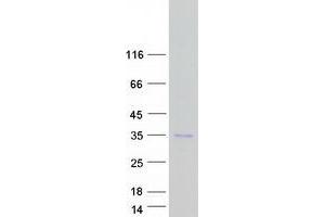 RAB12, Member RAS Oncogene Family (RAB12) protein (Myc-DYKDDDDK Tag)