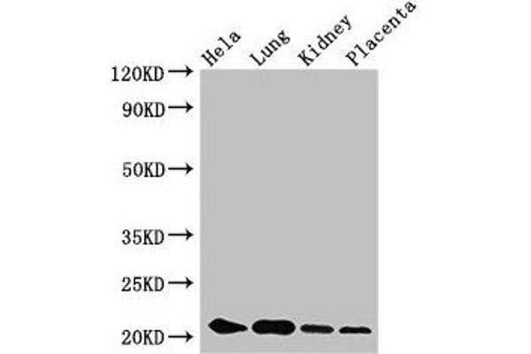 KRAB Box Domain Containing 4 (KRBOX4) (AA 1-98) antibody