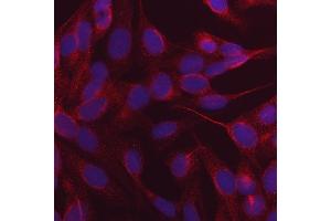 IF analysis of NDP52/CALCOCO2 using anti-NDP52/CALCOCO2 antibody (ABIN7599400). (CALCOCO2 antibody  (AA 1-446))