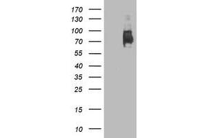 HEK293T cells were transfected with the pCMV6-ENTRY control (Left lane) or pCMV6-ENTRY LGALS3BP (Right lane) cDNA for 48 hrs and lysed. (LGALS3BP antibody  (AA 19-300))