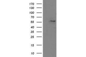 HEK293T cells were transfected with the pCMV6-ENTRY control (Left lane) or pCMV6-ENTRY ATP6V1B1 (Right lane) cDNA for 48 hrs and lysed. (ATP6V1B1 antibody)