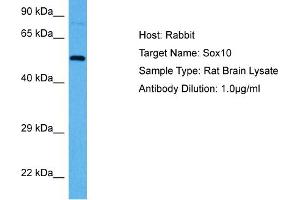 Host:  Rabbit  Target Name:  SOX10  Sample Tissue:  Rat Brain  Antibody Dilution:  1ug/ml (SOX9 antibody  (C-Term))