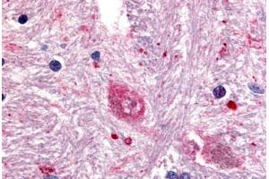 Human Brain, Caudate (formalin-fixed, paraffin-embedded) stained with GPR88 antibody ABIN213508 at 5 ug/ml followed by biotinylated goat anti-rabbit IgG secondary antibody ABIN481713, alkaline phosphatase-streptavidin and chromogen. (GPR88 antibody  (Cytoplasmic Domain))