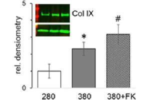 FK506 dose-dependently stimulates expression of fibrillar and minor collagens in physosmotic ATDC5 cultures. (Collagen Type IX alpha 2 (COL9A2) antibody)