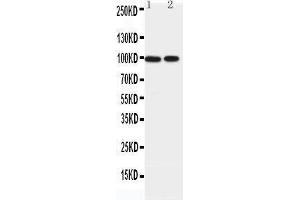 Western Blotting (WB) image for anti-erythrocyte Membrane Protein Band 4.1-Like 1 (EPB41L1) (AA 585-604), (C-Term) antibody (ABIN3042566)