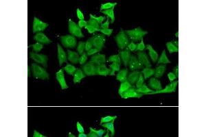 Immunofluorescence analysis of MCF-7 cells using RHOH Polyclonal Antibody (RHOH antibody)
