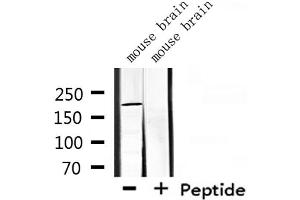 Western blot analysis of extracts from mouse brain, using CROCC Antibody. (CROCC antibody  (N-Term))