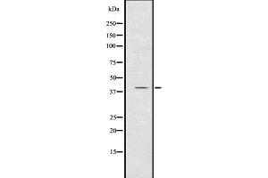 Western blot analysis of CXCR1 using K562 whole  lysates. (CXCR1 antibody  (N-Term))