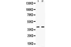 Western blot analysis of PSAT1 expression in rat pancreas extract ( Lane 1) and HELA whole cell lysates ( Lane 2). (PSAT1 antibody  (AA 276-370))