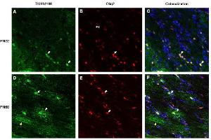 Immunohistochemical staining of perfusion-fixed frozen rat brain sections derived from post-natal day 22 (PN22) and from post-natal day 60 (PN60), using Anti-TMEM108 (extracellular) Antibody (ABIN7885615), followed by goat anti-rabbit- and Anti-OLIG2 Antibody, followed by goat anti-mouse-biotin and streptavidin-Cy3. (TMEM108 antibody  (Extracellular Loop))