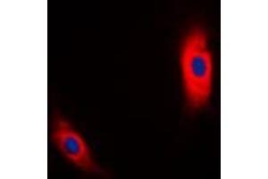 Immunofluorescent analysis of CK1 alpha staining in MCF7 cells. (CSNK1A1 antibody  (Center))