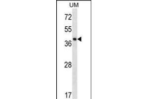 SPOPL Antibody (Center) (ABIN656695 and ABIN2845929) western blot analysis in uterus tumor cell line lysates (35 μg/lane). (SPOPL antibody  (AA 221-249))