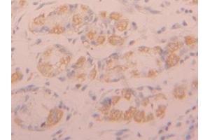Immunohistochemistry (IHC) image for anti-Fibroblast Growth Factor Receptor 1 (FGFR1) (AA 236-362) antibody (ABIN7434056)