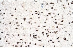 Human Brain (PGS1 antibody  (C-Term))