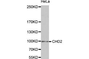 Western Blotting (WB) image for anti-Chromodomain Helicase DNA Binding Protein 2 (CHD2) antibody (ABIN1980262) (CHD2 antibody)