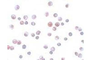 Immunohistochemistry (IHC) image for anti-Forkhead Box O1 (FOXO1) (N-Term) antibody (ABIN2473688)