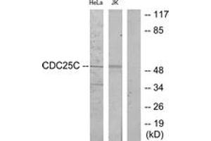 Western blot analysis of extracts from HeLa/Jurkat cells, using CDC25C (Ab-216) Antibody. (CDC25C antibody  (AA 183-232))