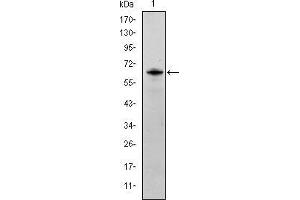Western blot analysis using FYN mAb against human FYN (AA: 7-176) recombinant protein.