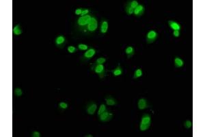 Immunofluorescence staining of MCF-7 cells with ABIN7150328 at 1:200, counter-stained with DAPI. (MCM2 antibody  (AA 2-904))
