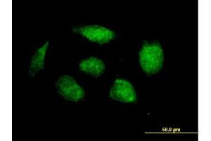 Immunofluorescence of purified MaxPab antibody to HOXB1 on HeLa cell. (HOXB1 antibody  (AA 1-235))