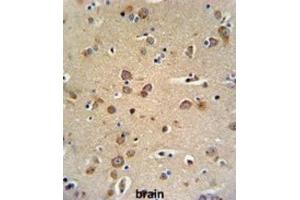 Immunohistochemistry (IHC) image for anti-gamma-aminobutyric Acid (GABA) A Receptor, gamma 3 (GABRG3) antibody (ABIN3002136) (GABRG3 antibody)