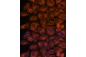 Immunofluorescence analysis of HeLa cells using SEC23IP antibody (ABIN7270170) at dilution of 1:100.