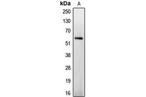 Western blot analysis of Caspase 8 (pS347) expression in Jurkat PMA-treated (A) whole cell lysates. (Caspase 8 antibody  (pSer347))