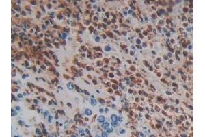 Immunohistochemistry (IHC) image for anti-Mannan-Binding Lectin Serine Peptidase 1 (MASP1) (AA 20-447) antibody (ABIN7434299)