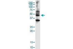 Western Blotting (WB) image for anti-Abhydrolase Domain Containing 5 (ABHD5) (AA 1-349) antibody (ABIN565526)
