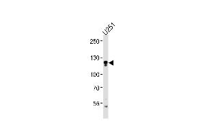 ECE2 Antibody (Center) (ABIN1881279 and ABIN2843411) western blot analysis in  cell line lysates (35 μg/lane). (ECE2 antibody  (AA 551-579))
