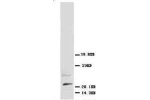 Western blot analysis of rat brain tissue lysis using NGFbeta antibody (Nerve Growth Factor antibody  (N-Term))