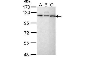 WB Image Sample (30 ug of whole cell lysate) A: H1299 B: Hela C: Molt-4 , 7. (SART1 antibody  (C-Term))